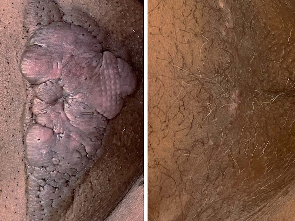pubic