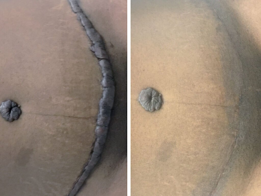 surgery-gallery-1