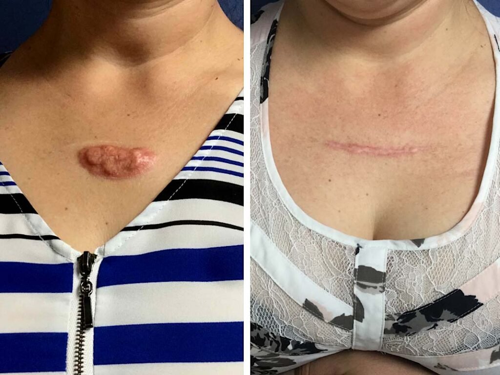 chest-gallery