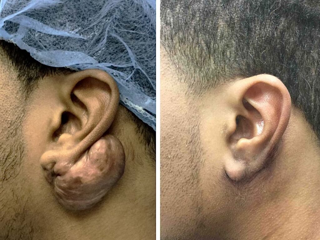 ear-gallery-10.jpg