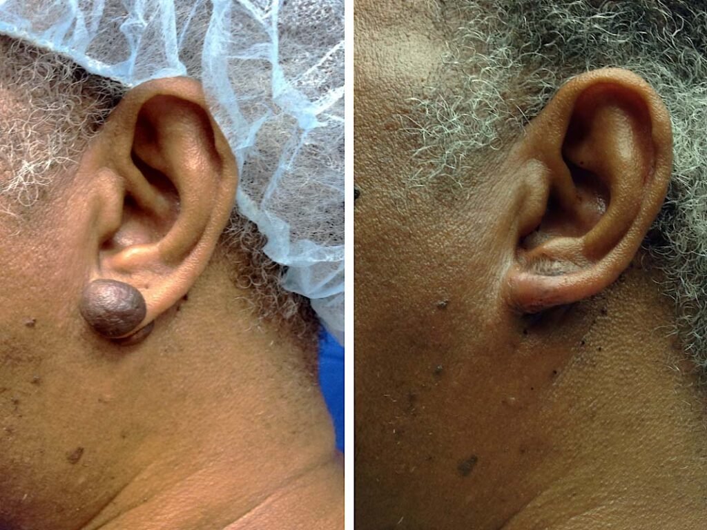 ear gallery1