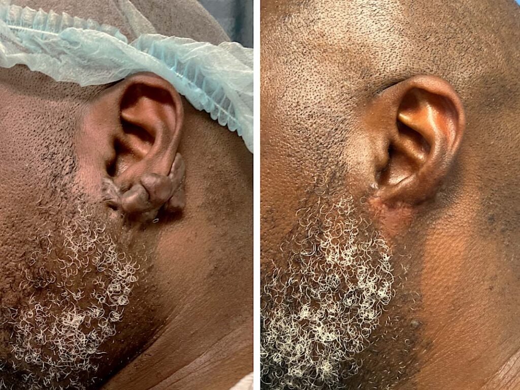 lpsadmin ear gallery