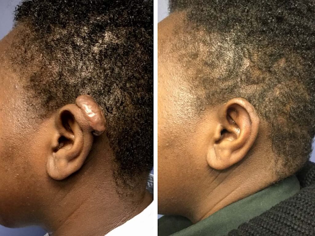 lpsadmin ear