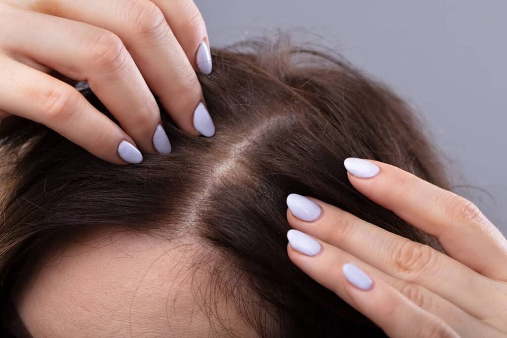 Hair-Restoration