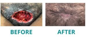 Before and after wound healing treatment